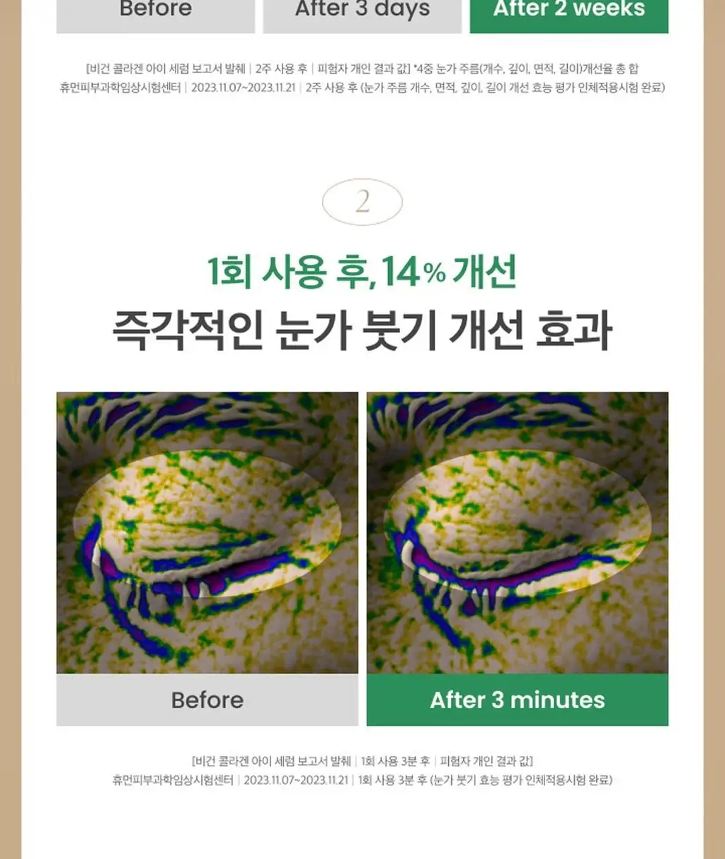 [탱탱아이볼세럼/탄력] 엑시스와이 비건 콜라겐 아이세럼 10ml 상세페이지 8